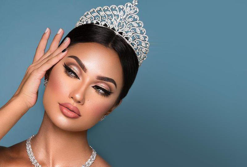 البني الفاتح في الزوايا الداخلية للعين
