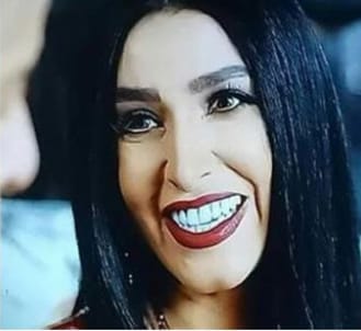 أسنان روجينا في مسلسل البرنس تفضخها وتفضح المخرج!