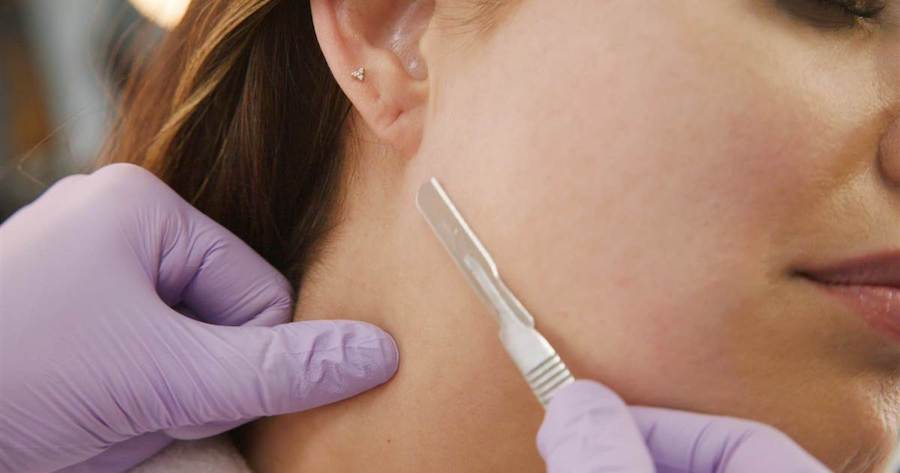 كم من الوقت يستغرق Dermaplaning